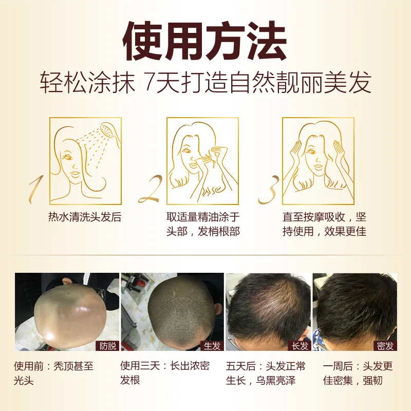 1pc pilatory stop hair loss fast growth products for men and woman essence grow restoration 30ml | Красота и здоровье