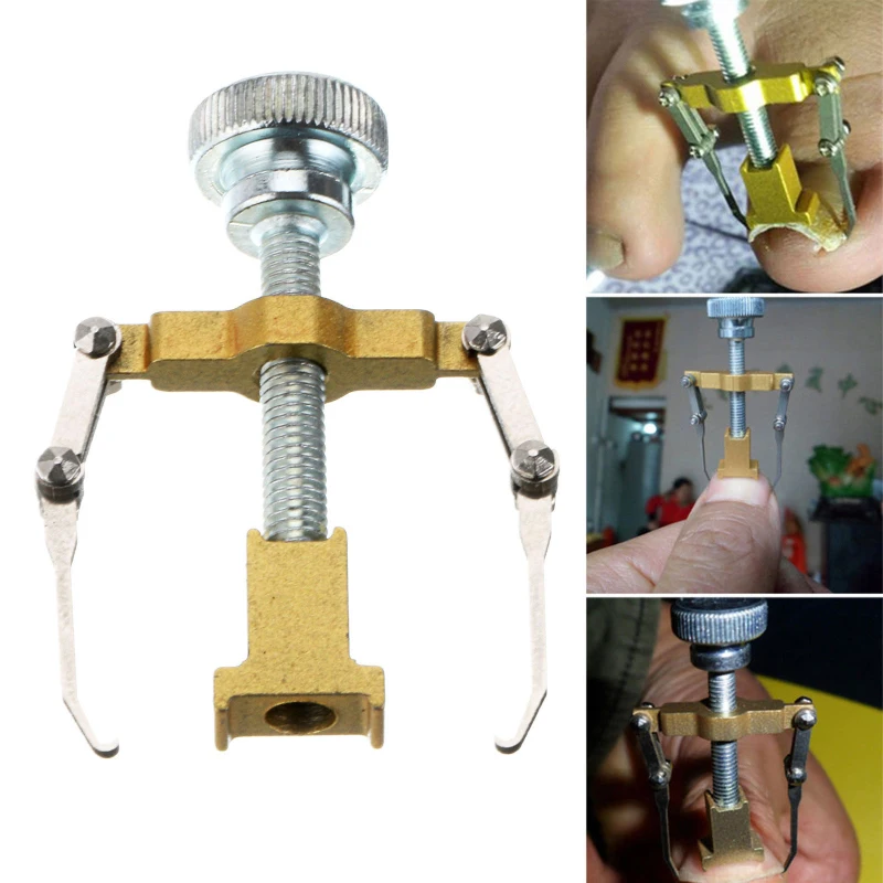 2PC Ingrown Toe Nail Recover Correction Tool Pedicure Toenail Fixer Foot Care | Красота и здоровье