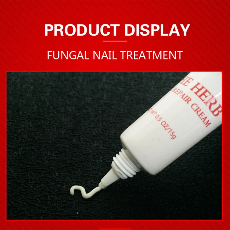 Nail Treatment Care Essence Whitening Removal Gel Fungal Cream | Красота и здоровье