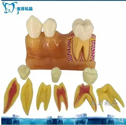 Four times the teeth decompose the tooth model explains the pulp and anatomy of the oral cavity model