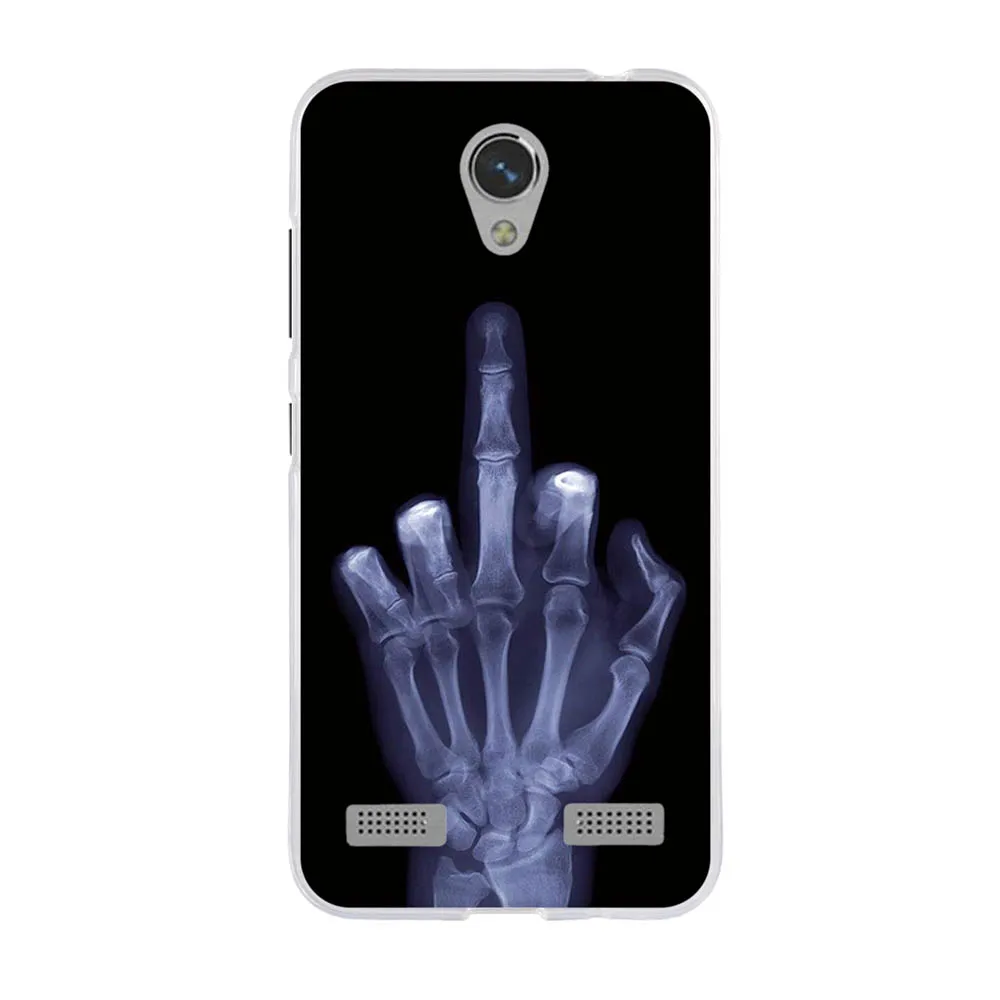 

Phone Case For ZTE Blade BA520 Printing Painted Cover Case For ZTE Blade BA 520 5.0" Cover Shells for ZTE Blade A520 BA520 Bags