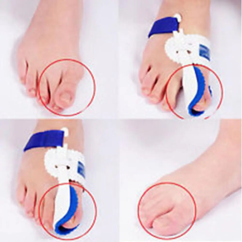 Bunion Device Hallux Valgus Orthopedic Braces Toe Correction Night Foot Care Tools Corrector Thumb Big Bone Orthotics | Красота и