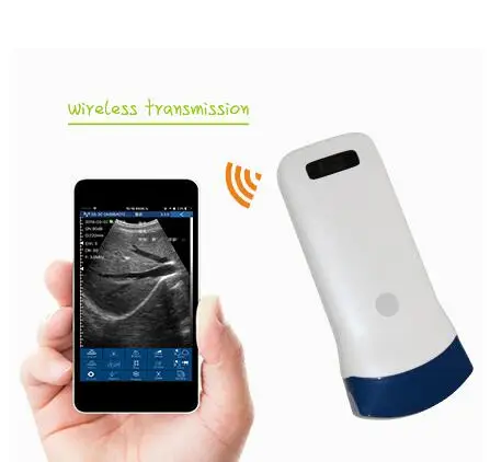 

Wireless ultrasound convex array probe Uprobe with color, CF, PW, PDI funtion Color doppler version 128element, 3.5/5MHz