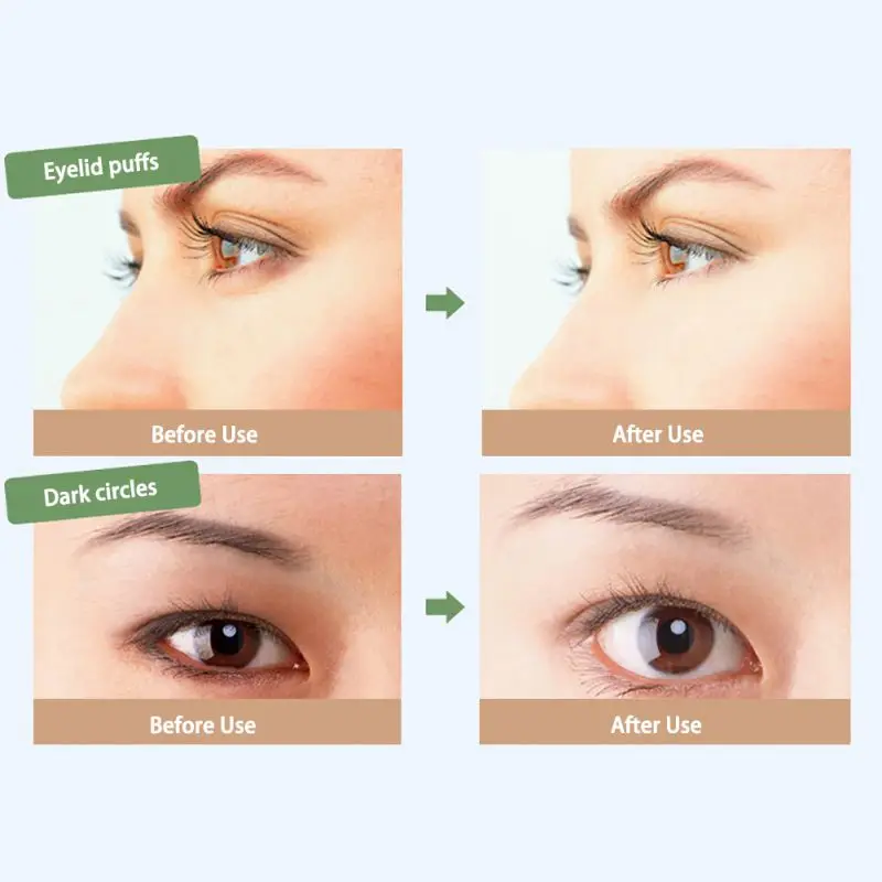 Eye Cream Face Gold Essence Granule Anti Repairing Dark Circles Bag Wrinkles For Night Females Lady Puffiness 30g M2 |