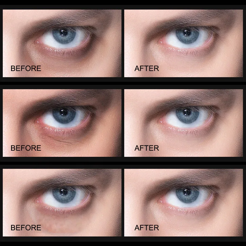 Мужская Сыворотка для глаз с гиалуроновой кислотой против старения отечности