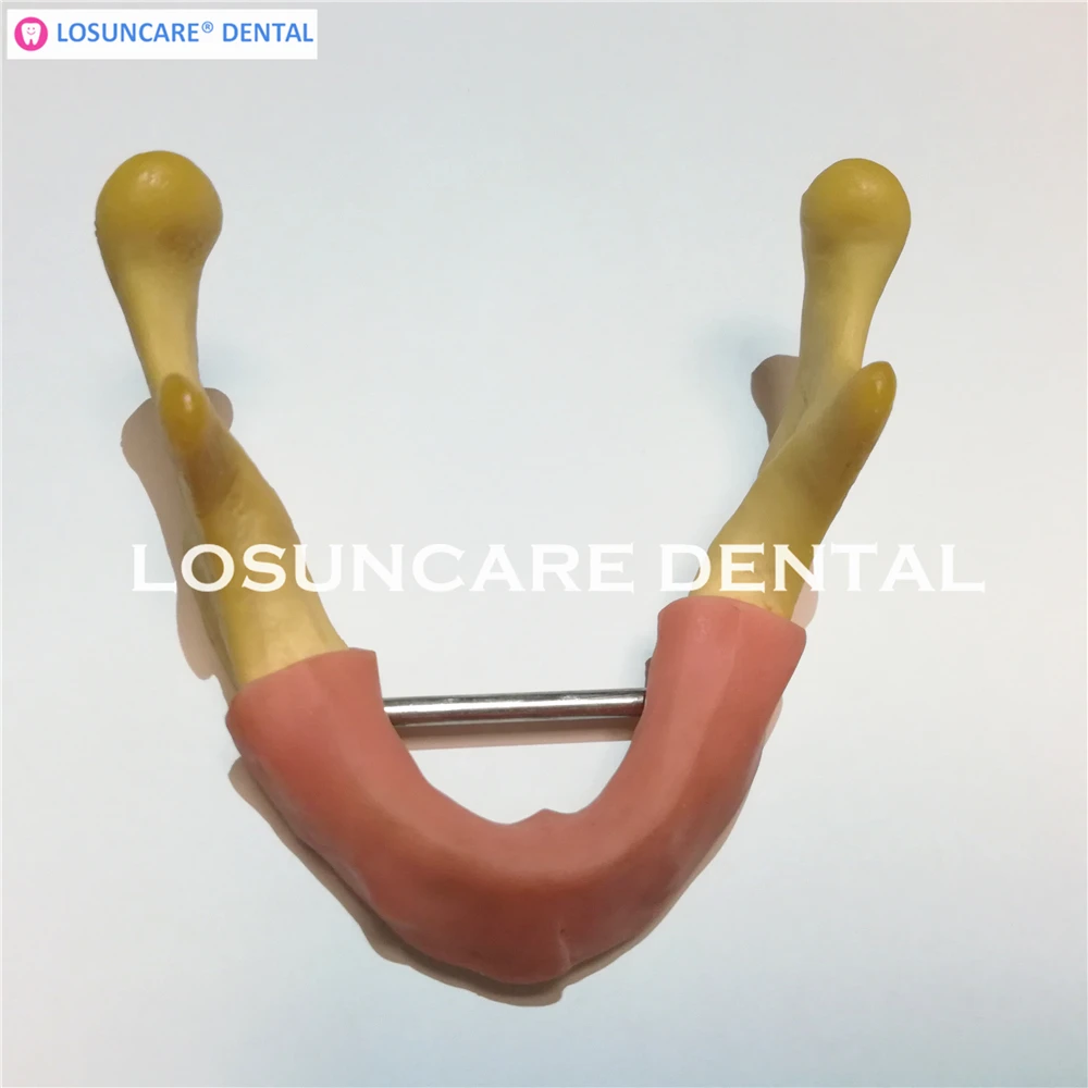 LOSUNCARE зубная модель имплантации тренировочный инструмент с мягкой тканью |