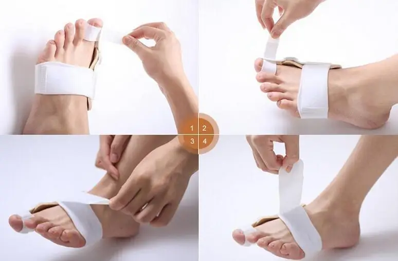 

Corect posture big Toe Bunion Splint Straightener Stabilizer Corrector Pain Relief Foot Hallux Valgus Fracture Sprains