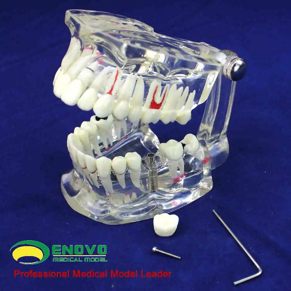 

Oral and dental models of oral cavity diseases