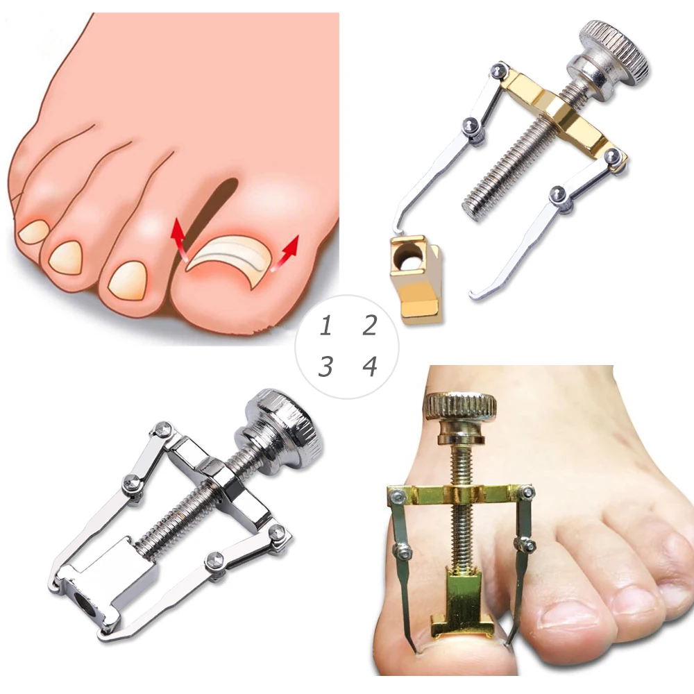 1 Набор корректоров для ног вросших ногтей педикюра пилок ухода за ногами Bunions