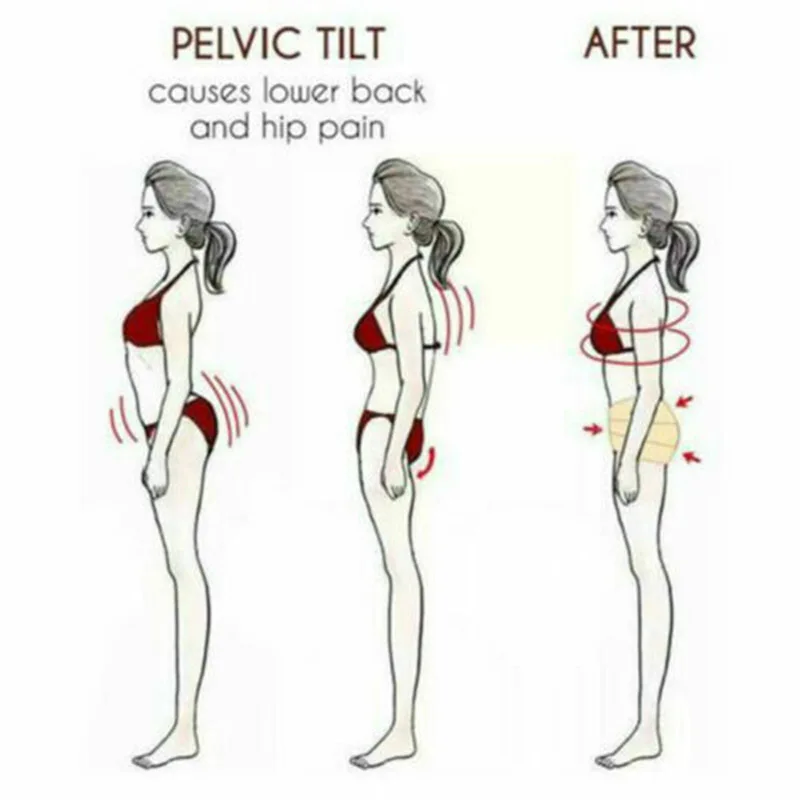 Новинка корректирующий пояс для таза Женский послеродовой живота 19ing|Брекеты и