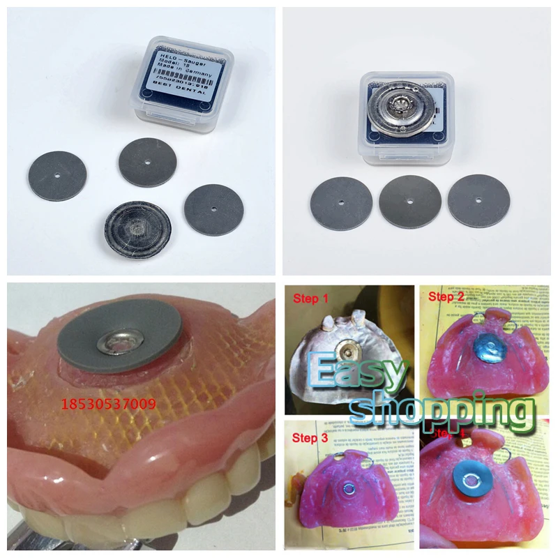 Стоматологическая присоска для удержания пластины полного верхнего или