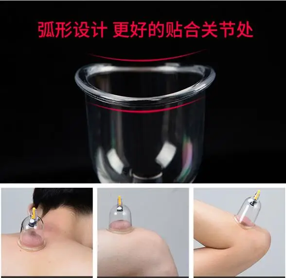 Вакуумный медицинский Массажер для акупрессуры акупрессурный массаж облегчения