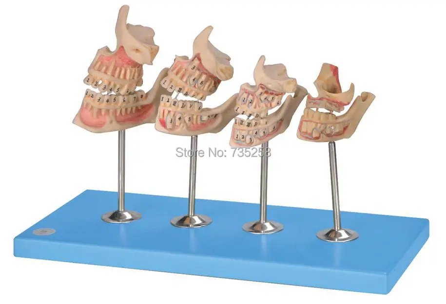 

Разработка набора зубов, модель процесса разработки зубов, модель увеличения зубов