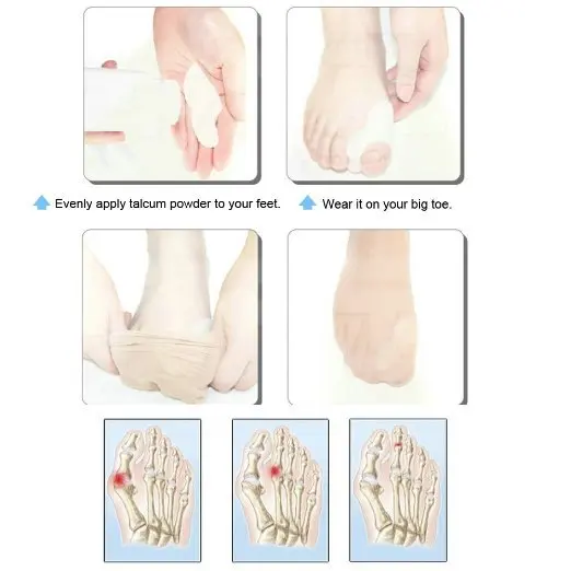 

Toe Stretchers-2pairs Silicone Gel foot fingers Toe Separator valgus protector Bunion adjuster Perfect Aid For Hallux Valgus
