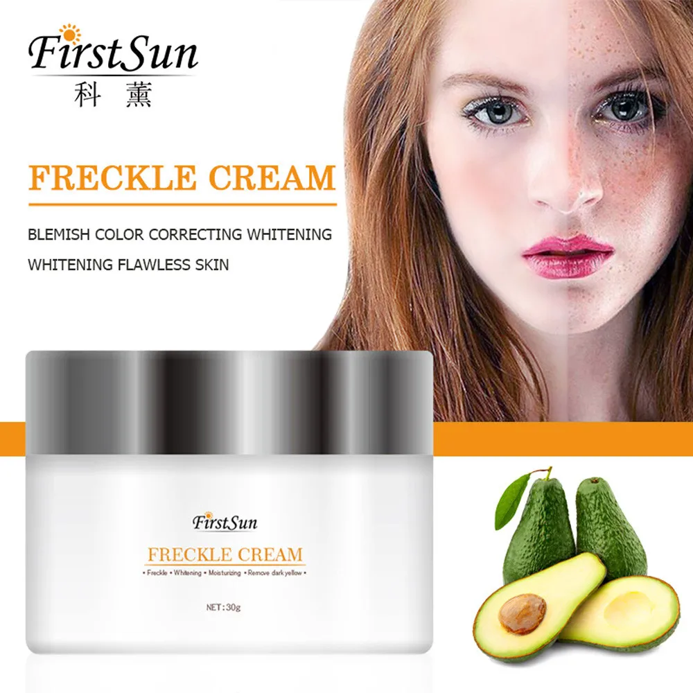 2018 новый стиль крем от веснушек экстракт удаления акне шрамы лечения лица 30 г