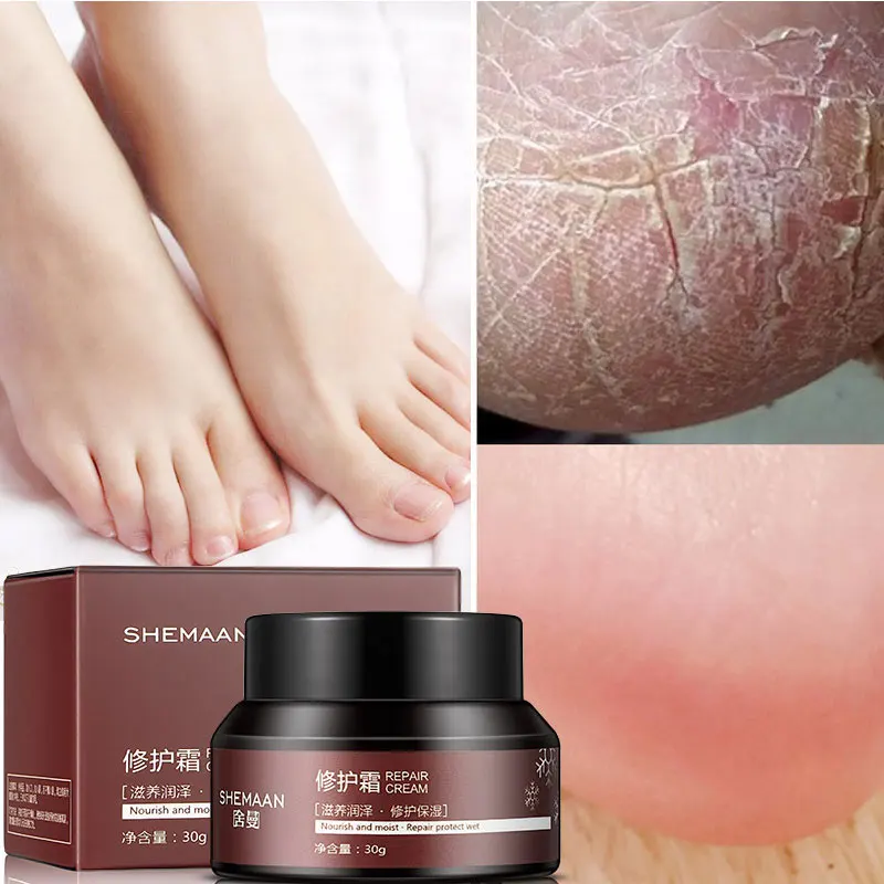 SHEMAAN крем для ног анти сухую потрескавшуюся ноги обморожения глубоко увлажняющий