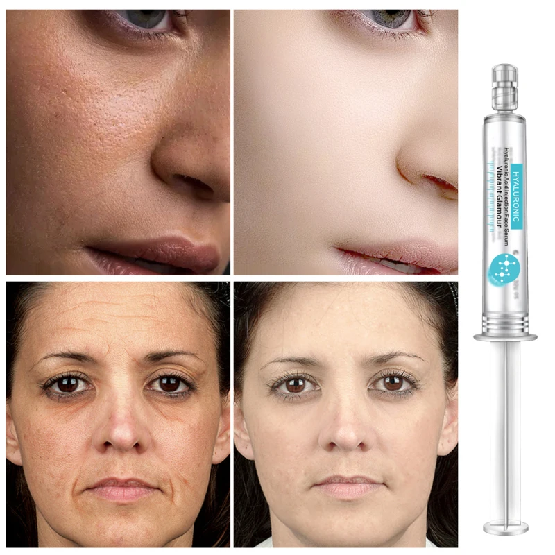 VIBRANT GLAMOUR Hyaluronic Acid Face Serum Moisturizing Whitening Anti-wrinkle Acne for Skin care TSLM1 | Красота и здоровье
