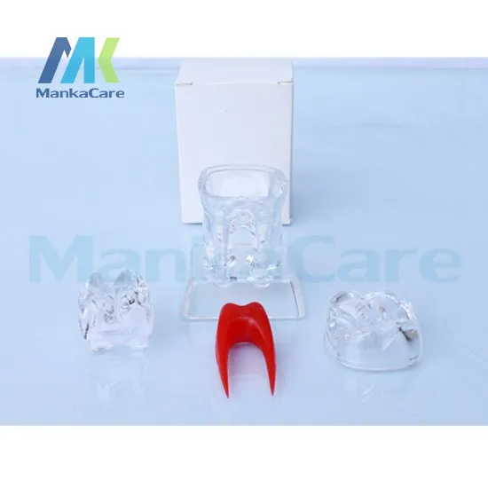 Устные модель 4 раза больше чем зубной имплантат заболеваний зубов Модель с