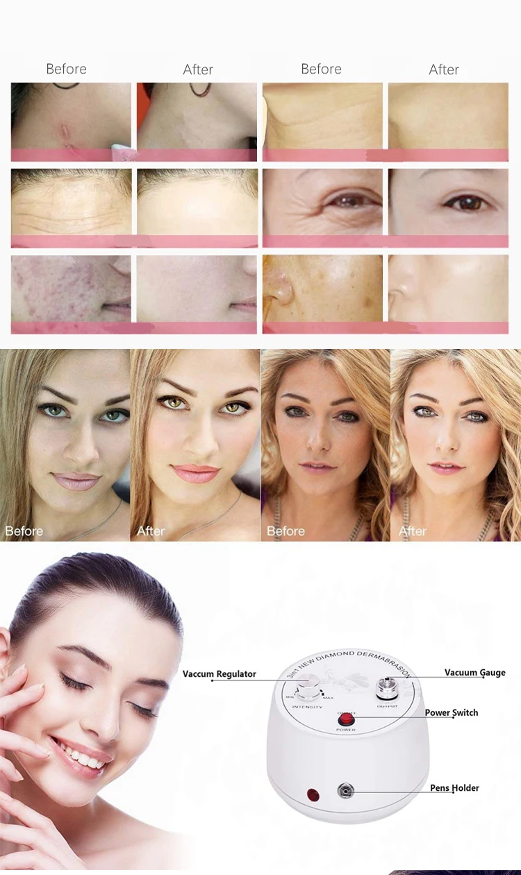 3 in 1 Water Spray Exfoliation Beauty Machine Diamond Microdermabrasion Dermabrasion Machine Wrinkle Removal Facial Peeling SPA