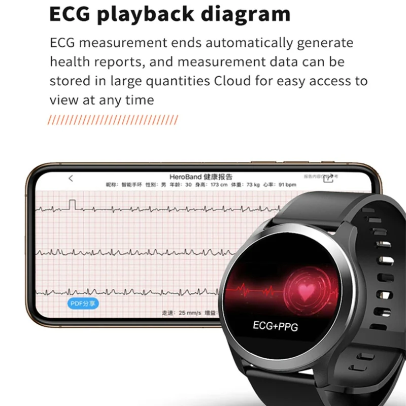 Focusmart 2019 New Z03 Smart Watch ECG PPG Electrocardiograph Fitness tracker Blood Pressure Smartwatch For IOS Andriod | Электроника