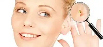 Магнитный Магнит для похудения система самолечения потери веса ушей