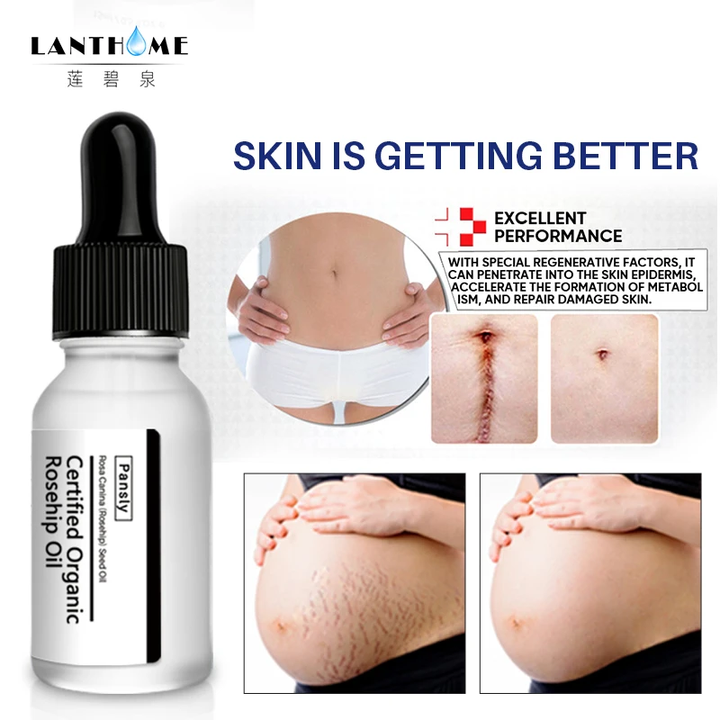 PANSLY масло шиповника шрамы после беременности удаление эфирных масел растяжек