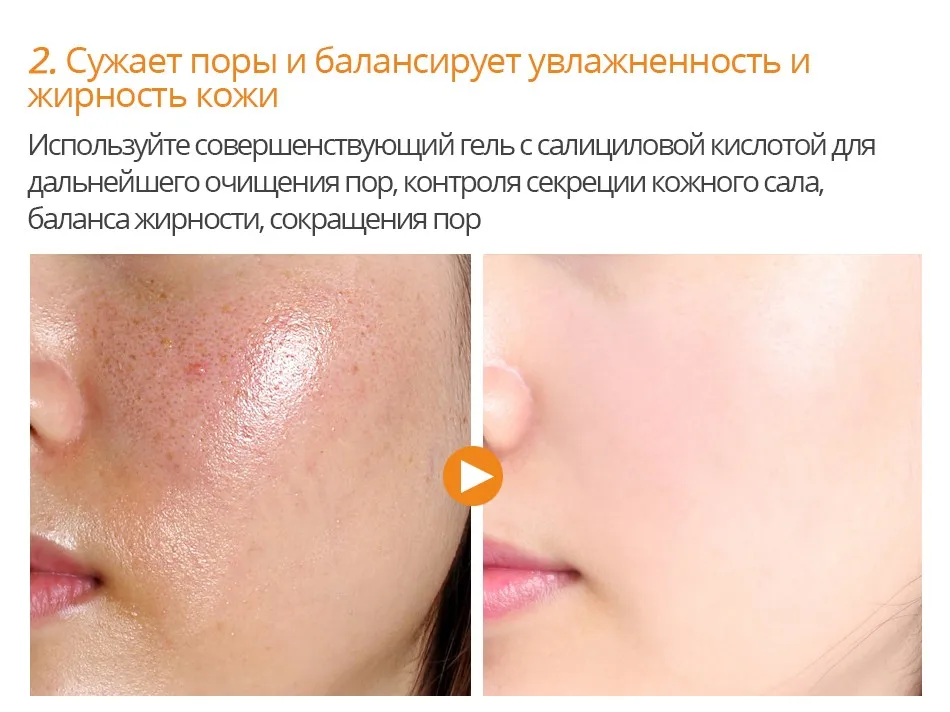 Яркие гламур салициловая кислота конденсации маска для ухода за кожей лечение для устранения акне масла Управление пигментации корректирующий крем