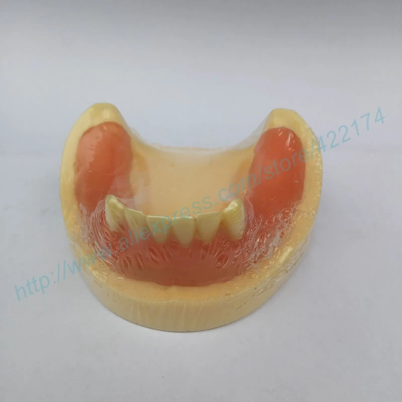 

Free Shipping Implant practice model with gum dental tooth teeth dentist anatomical anatomy model odontologia