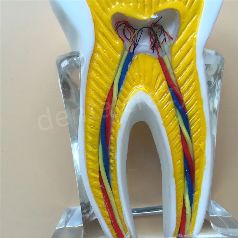 Dental Anatomical Molar Model molar inner structure with nerves and vessels Teeth 2018 | Красота и здоровье