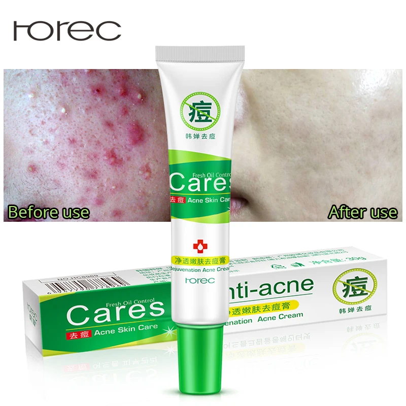 ROREC лечение акне набор кремов для лица + эссенция гиалуроновой кислоты анти