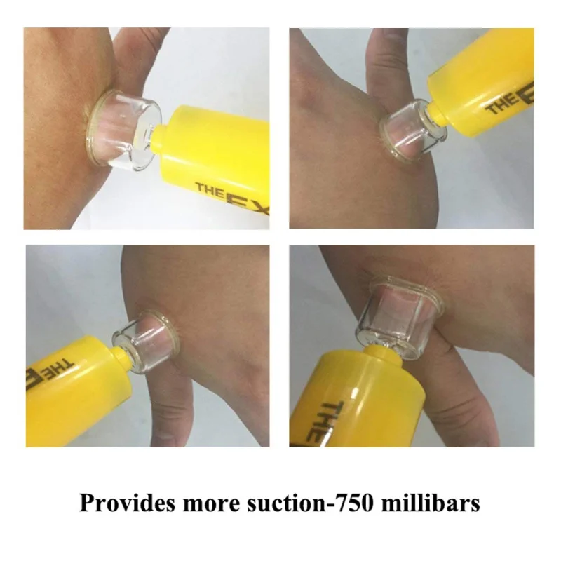 Практичное вакуумное устройство для детоксикации яда всасывающее наружного