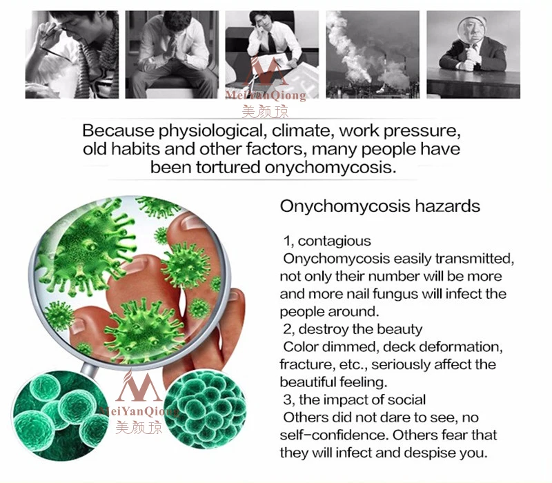 Травяной крем для восстановления ногтей онихомикоз паронихия противогрибковая