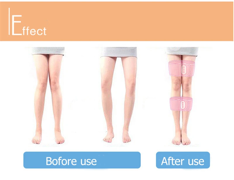 JORZILANO бедра O/X-type Коррекция ног Пояс Bowlegs леггинсы, лента для ортерации ног лента Корректор осанки пояс для детей