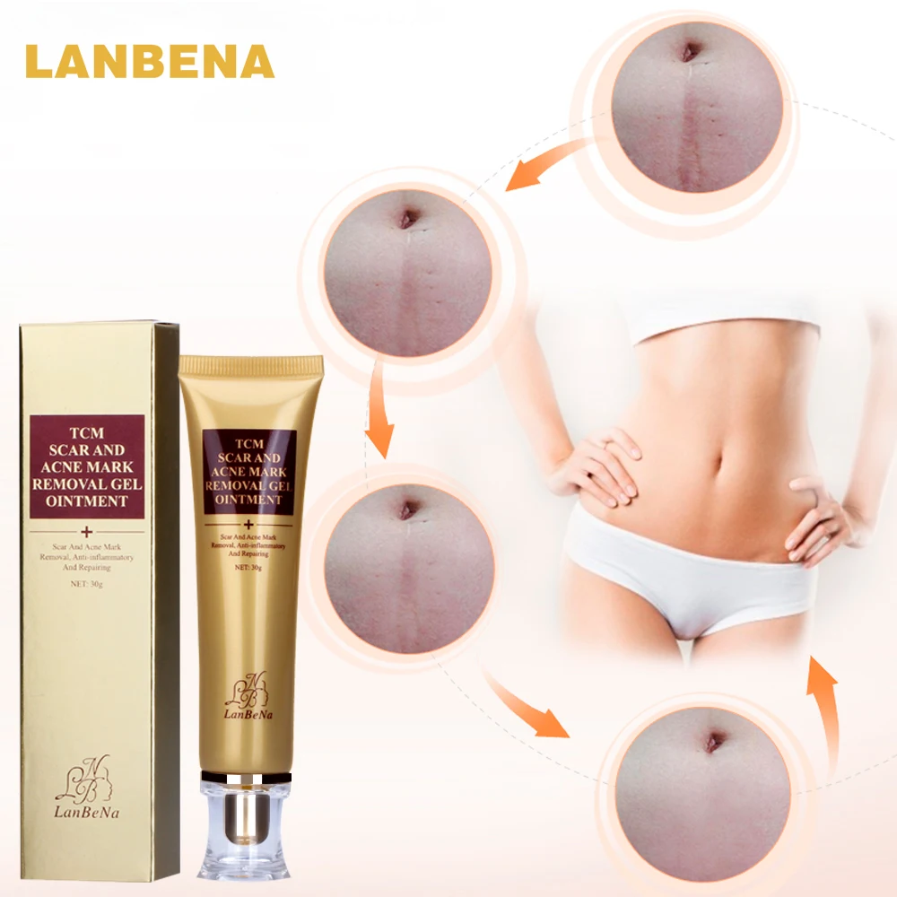 

LANBENA , , , 30