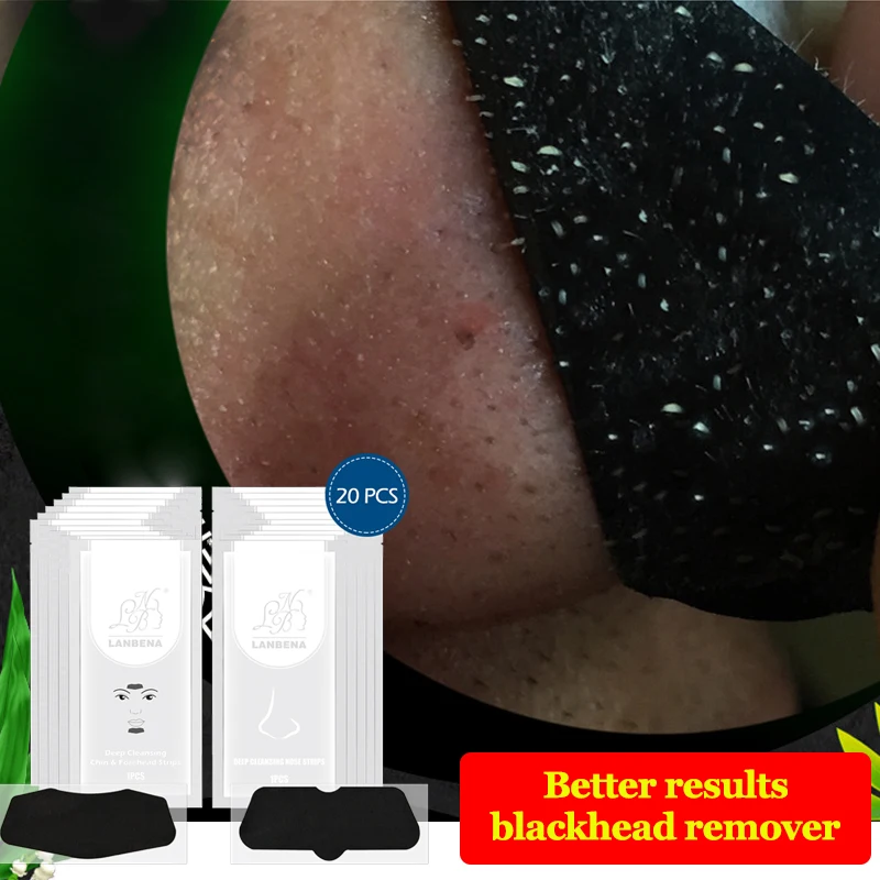 20 шт. маска для удаления черных точек на лице и подбородка|black mask peel|black head maskblack |