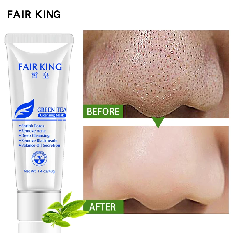 Новинка для ухода за кожей лица маска blackhead удаления прыщей лечение нос контроль