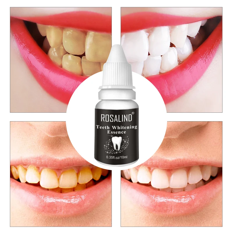 Распродажа! ROSALIND Стоматологический материал отбеливание зубов эссенция гигиена