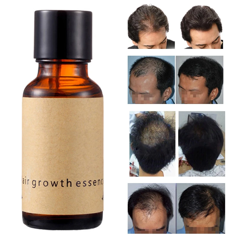 Новая классическая маска для волос с экстрактом имбиря, средство по уходу, питание сухих/поврежденных волос J11.