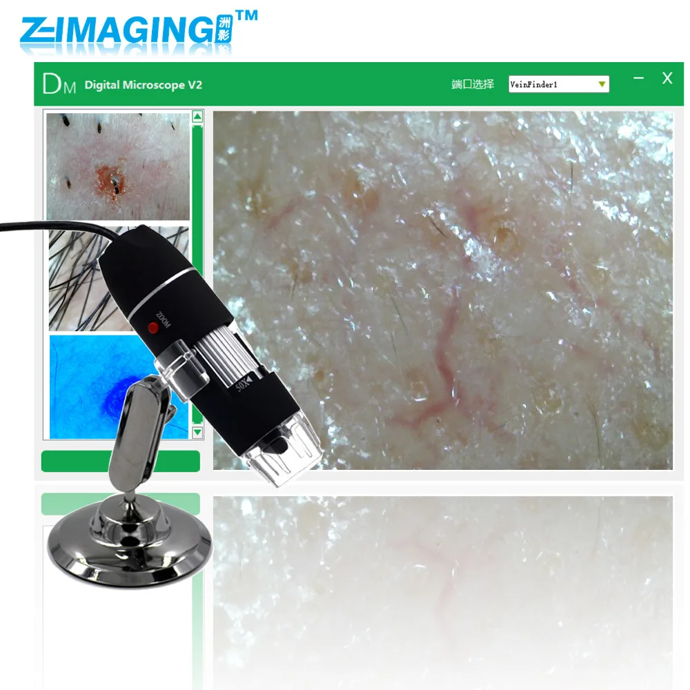 

Anti Redness USB Digital Microscope Scalp Hair Couperose Skin Detector With OTG Function True 5.0MP Camera Magnifier With Base