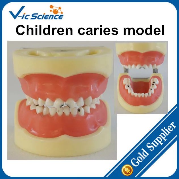 Children Teeth Caries Model