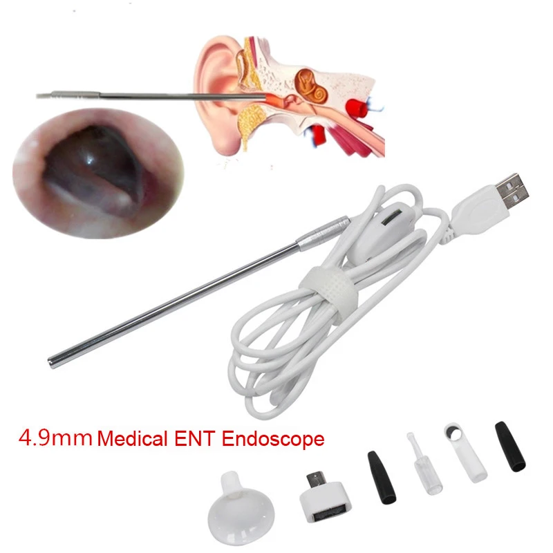 Новый 4 9 мм объектив медицинский USB Ухо Нос зуб эндоскоп OTG Android телефон ПК