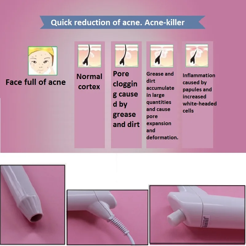 

Red & Violet Light Portable High Cycle Frequency Electrotherapy Instrument Can Sterilize Disinfect Whiten & Promote Hair Growth