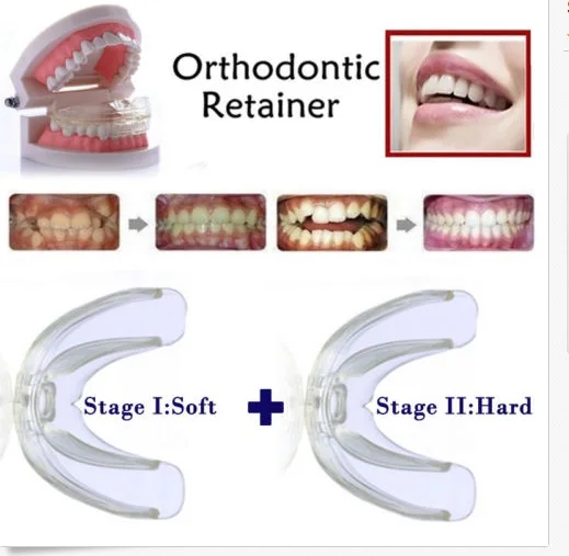 High-tech Dental Orthodontic Braces - Transparent Soft and Hard For Adults Teeth Straightening | Красота и здоровье