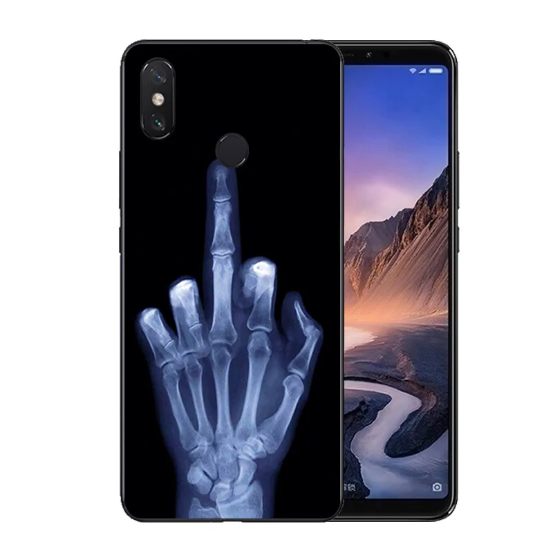Silicone Cell Phone Case For Xiaomi Redmi Note 6 Pro 4A 4 3 Hand Pattern Protection Mi A1 Max Max2 |