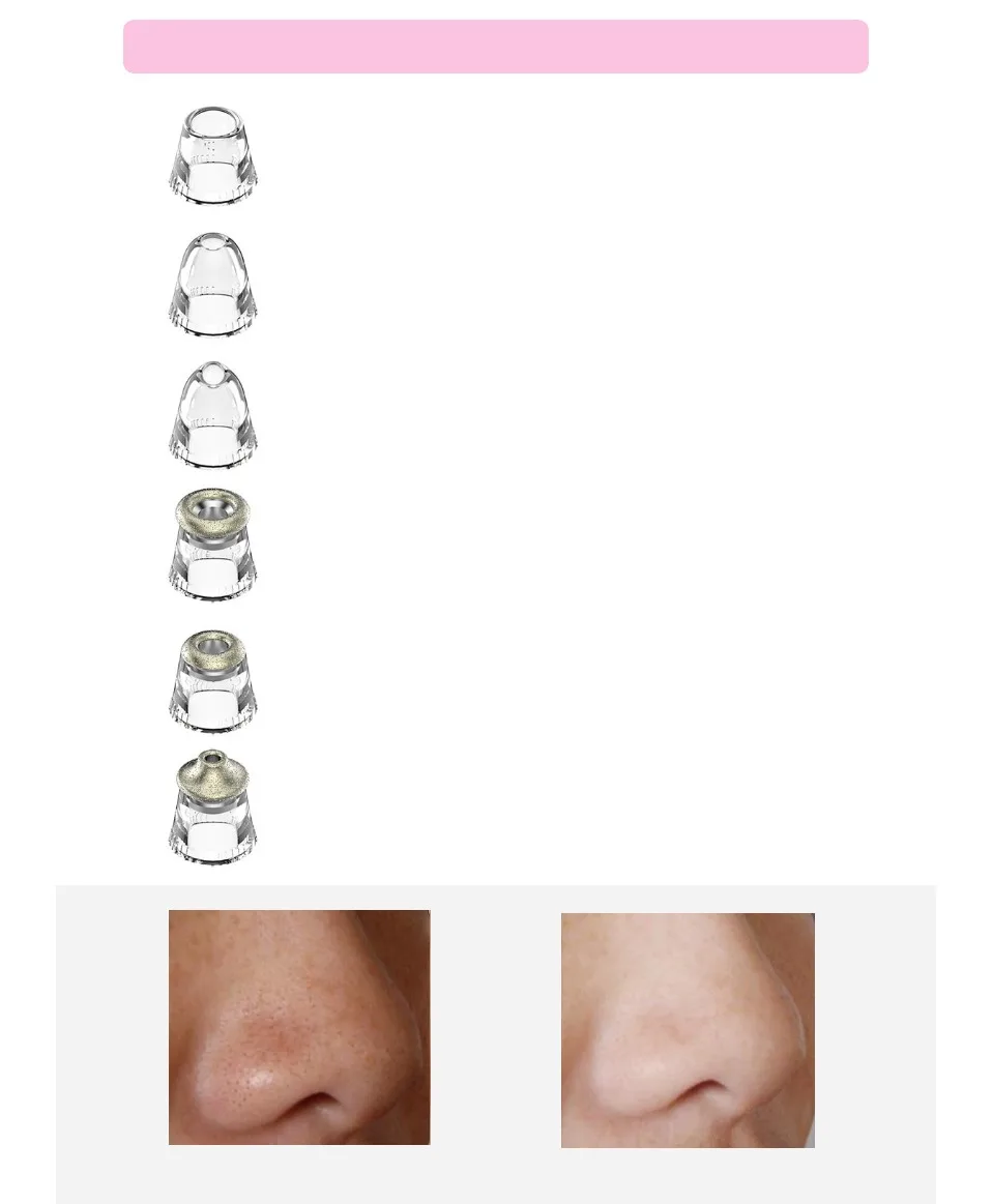 Пылесос DARSONVAL Blackhead для глубокой очистки пор, удаление угрей, Микродермабразия, USB зарядка инструмент для ухода