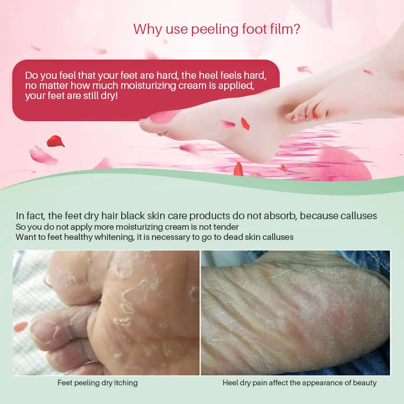 1 упаковка отшелушивающая маска для ног|foot mask|exfoliating foot maskfoot peeling mask |