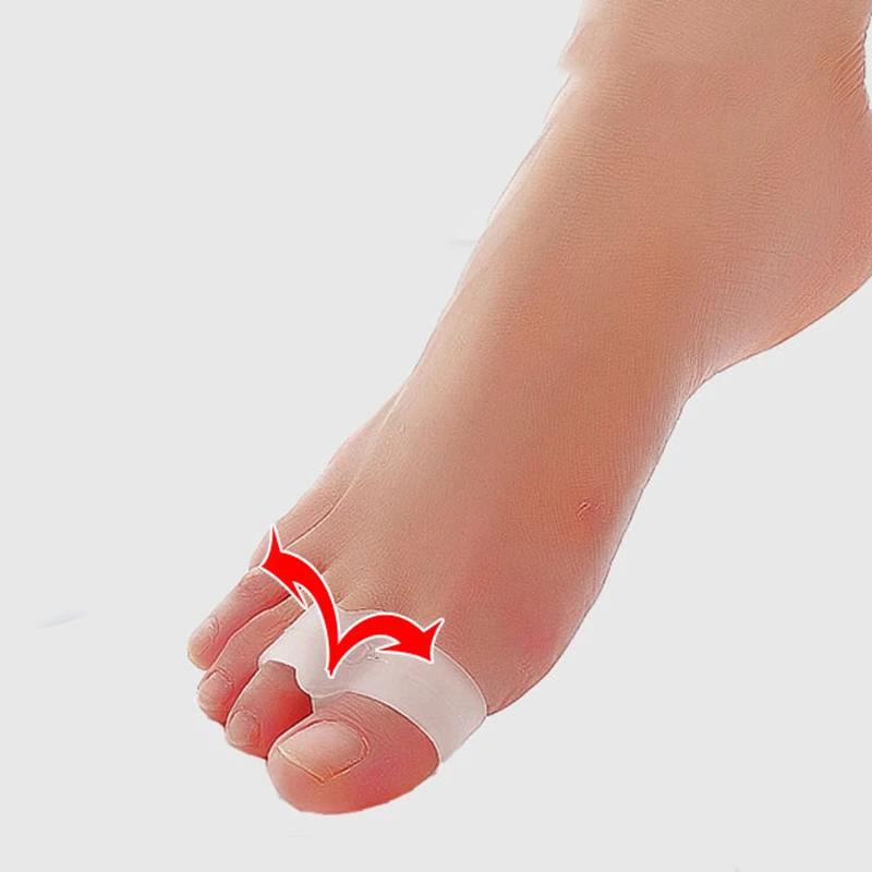 1 пара мягких силиконовых гелевых сепараторов для пальцев ног/носилки Bunion