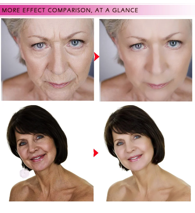 Гиалуроновая кислота коллагеновая маска для лица Сыворотки лечение акне