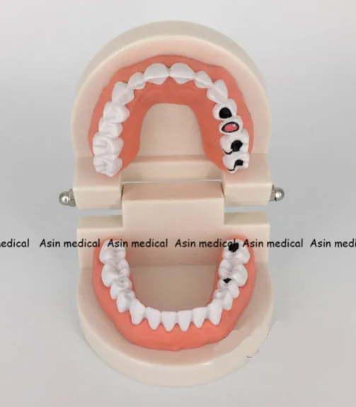 

High Quality Dental tooth model Early childhood teaching model The teaching model of oral teeth in children