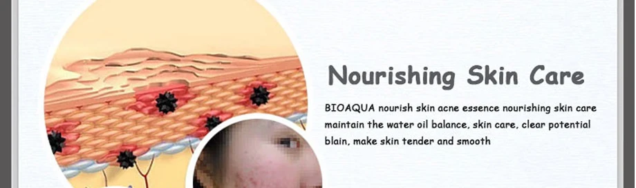 Бренд BIOAQUA, 30 мл, лечение акне, субстанция от угревой сыпи, удаление шрамов, прыщей, пятен, уход за кожей лица, отбеливание, увлажнение, уход за лицом